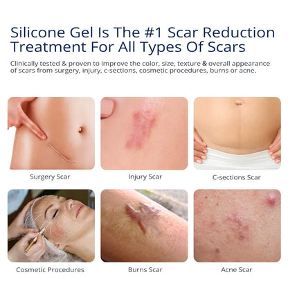 100% Silicone Scar Gel Scar Cream - Advanced Scar Gel for Old and New Scars - Available at All In One Marketplace Canada