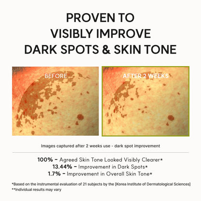 Arencia Vitamin C Booster Shot Serum with Glutathione, Niacinamide and Vitamin E for Dark Spot Care, Fine Lines & Wrinkles, Glass Skin, Korean Skincare 30ml