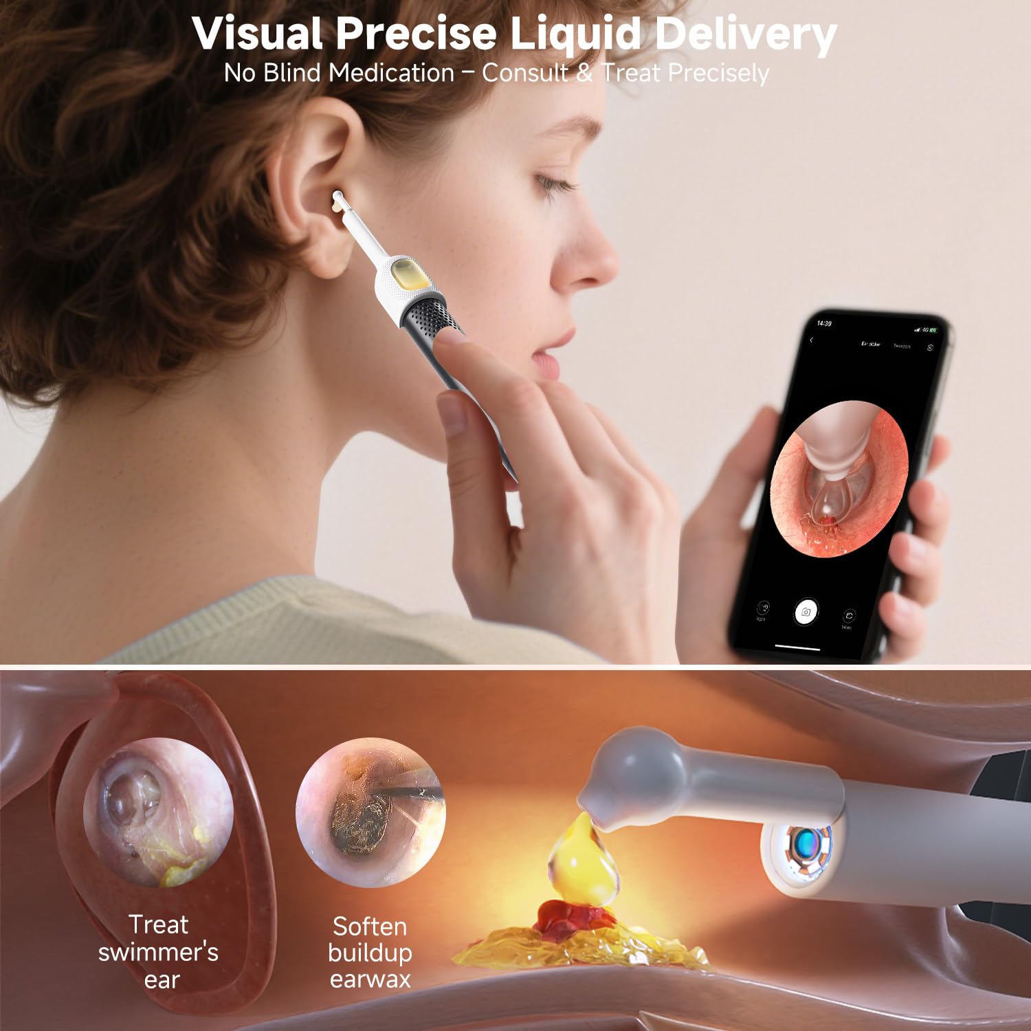 Bebird Ear Wax Removal Tools, Bebird Ear Cleaner, 1080P HD Endoscope, Wireless Earwax Removal Tools with 6 LED Lights, Compatible with iPhone & Android and Kids, Adults (Black) - Available at All In One Marketplace Canada
