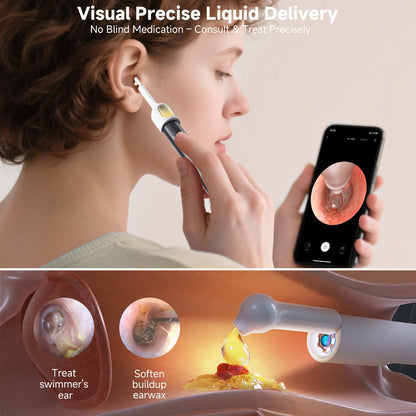 Bebird Ear Wax Removal Tools, Bebird Ear Cleaner, 1080P HD Endoscope, Wireless Earwax Removal Tools with 6 LED Lights, Compatible with iPhone & Android and Kids, Adults (Black) - Available at All In One Marketplace Canada