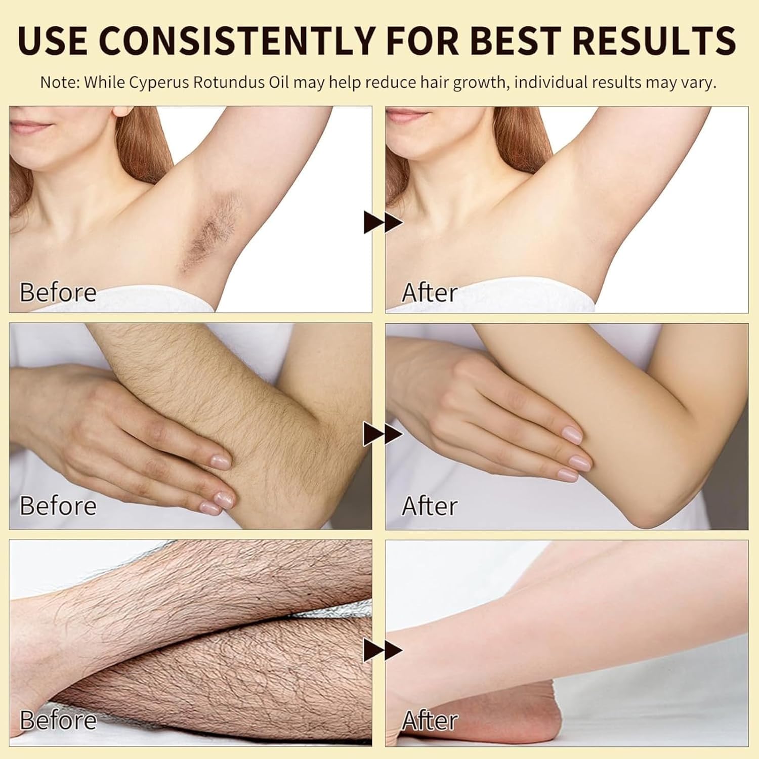 Cyperus Rotundus Oil, Natural Cyperus Rotundus Oil For Hair Removal, New upgrade Reduces Unwanted Hair Growth, Hair Removal & Smooth Skin, Suitable For All Skin Types - 60ml/2.02 Fl Oz -new - Available at All In One Marketplace Canada