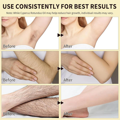Cyperus Rotundus Oil, Natural Cyperus Rotundus Oil For Hair Removal, New upgrade Reduces Unwanted Hair Growth, Hair Removal & Smooth Skin, Suitable For All Skin Types - 60ml/2.02 Fl Oz -new - Available at All In One Marketplace Canada