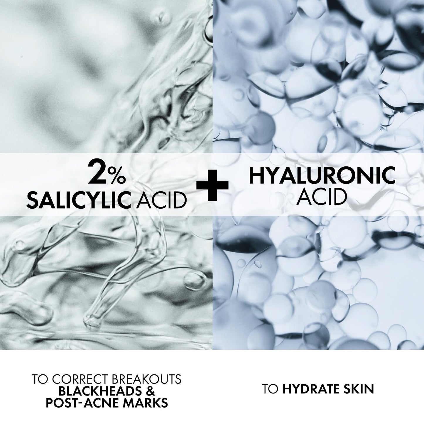 Vichy Face Cream for Acne-Prone Skin, Normaderm Double-Action Anti-Acne Face Moisturizer with Salicylic Acid, Oil-Free, Non-Comedogenic, Hypoallergenic, & Paraben-Free, 50mL VICHY