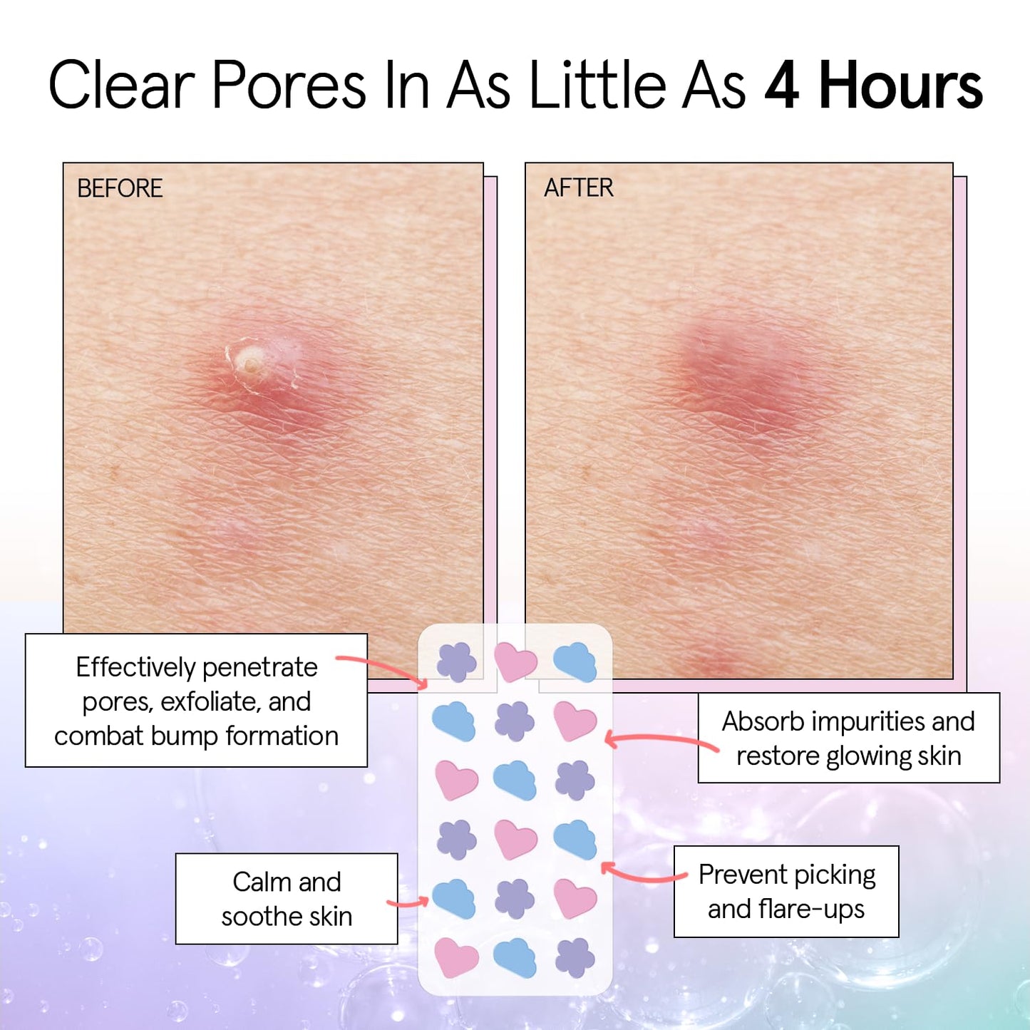 grace & stella Award Winning Skin Rescue Covers with Hydrocolloid (Multishape, 72 Count) - With Salicylic Acid and Tea Tree for Absorbing Impurities - Dermatologist Tested Skin Care, Cruelty Free, Vegan