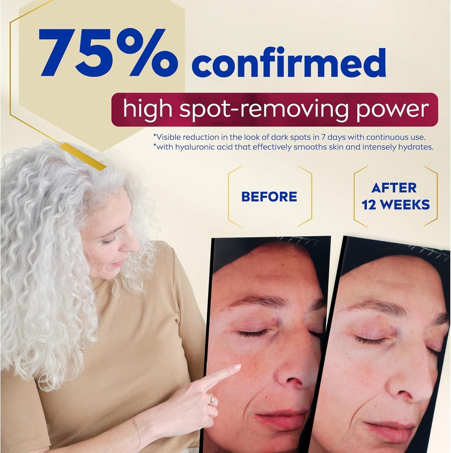 NIVEA LUMINOUS630 Dark Spot Solution Advanced Face Serum for All Skin Types, Dark Spot Serum Visibly Reduces Dark Spots in Just 2 Weeks, Hyaluronic Acid Serum, Dermatologically-Tested Skin Care, 30mL - Available at All In One Marketplace Canada