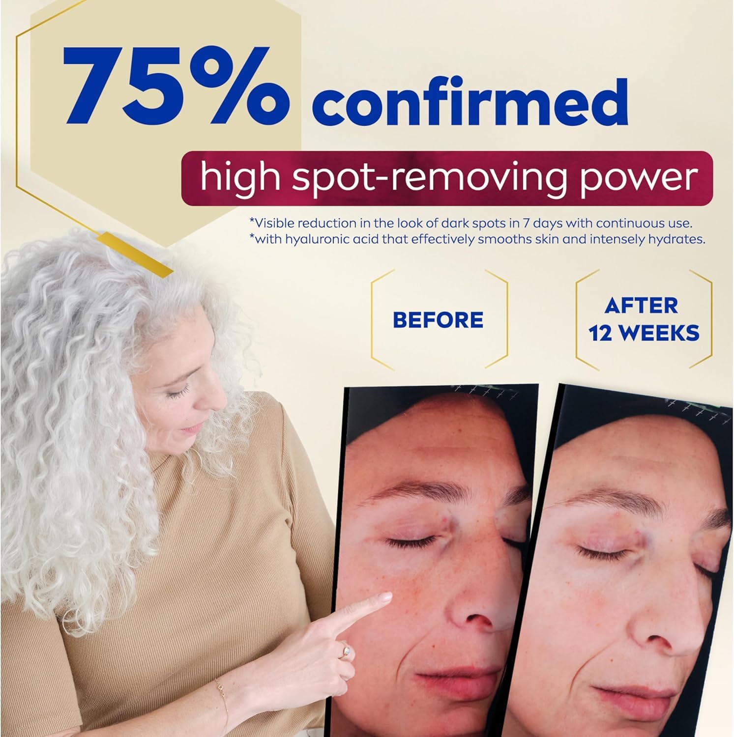 NIVEA LUMINOUS630 Dark Spot Solution Advanced Face Serum for All Skin Types, Dark Spot Serum Visibly Reduces Dark Spots in Just 2 Weeks, Hyaluronic Acid Serum, Dermatologically-Tested Skin Care, 30mL - Available at All In One Marketplace Canada