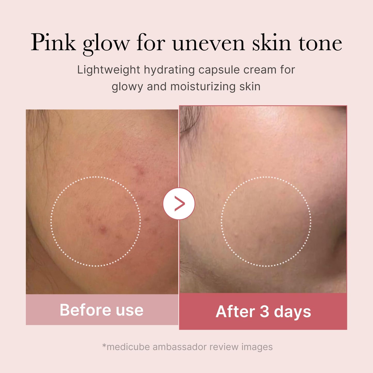 medicube Salmon DNA PDRN Pink Collagen Capsule Cream, Face Moisturizer | Lightweight Moisturizing Cream | PDRN, Niacinamide for Uneven Skin Tone, Glow hydration | Korean Skin Care 1.94 oz