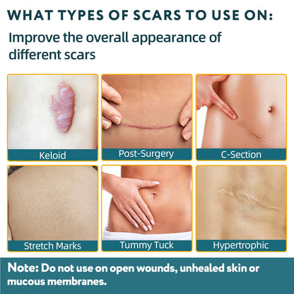 Silicone Scar Sheets, Silicone Scar Tape for Surgical Scars - 60" x 1.6" Roll - 1.5M, Medical Grade Reusable Scar Removal for Keloid, C-Section, and Tummy Tuck - Available at All In One Marketplace Canada