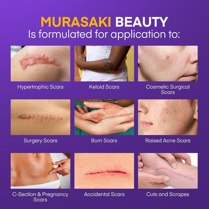 Silicone Scar Gel Scar Cream - SPF 30 Advanced Scar Gel for Old and New Scars - Available at All In One Marketplace Canada
