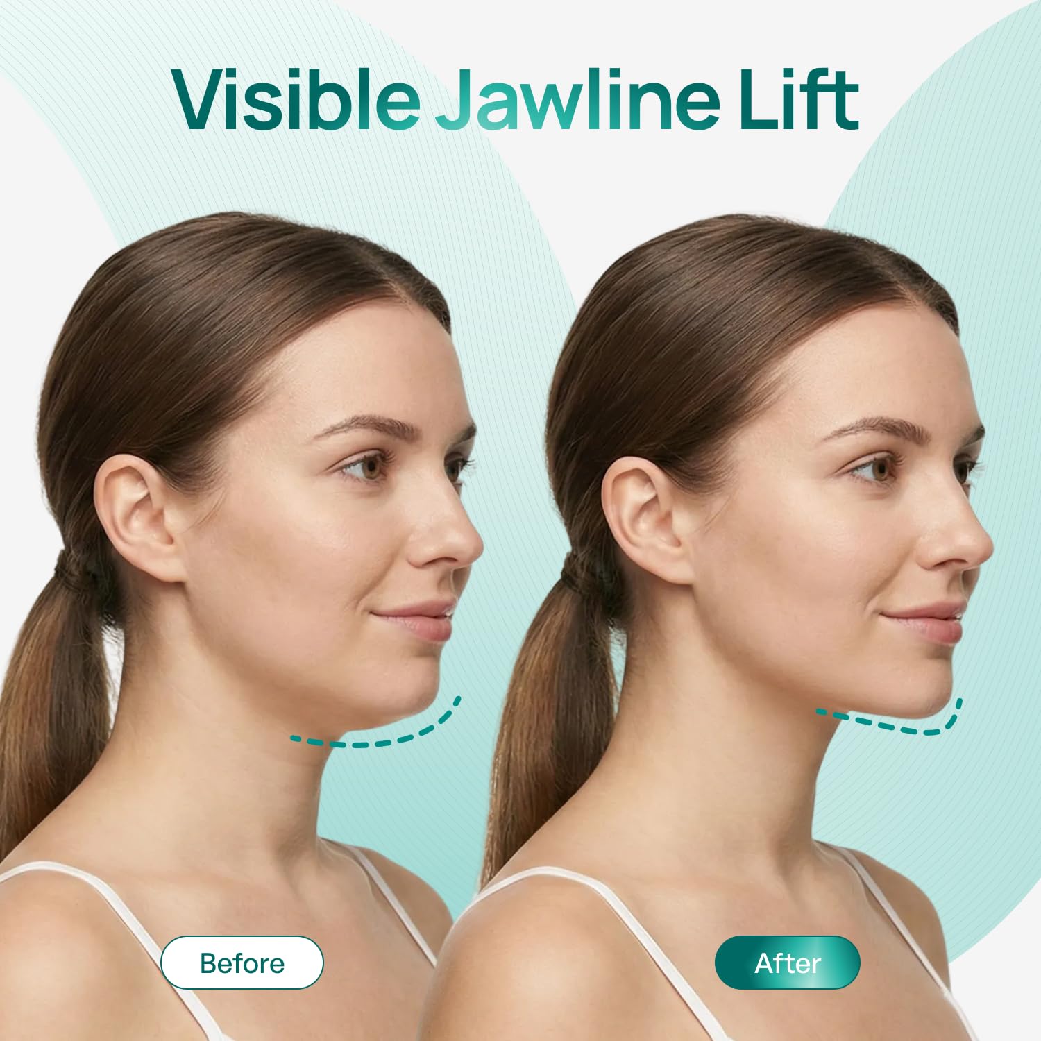 Plantifique V-Line Face Mask with Hyaluronic Acid, 5 Pack Chin Strap for Double Chin, V Line Lifting Masks - V Shape Face Tape, Jawline & Neck Mask for Skin Firming - Available at All In One Marketplace Canada