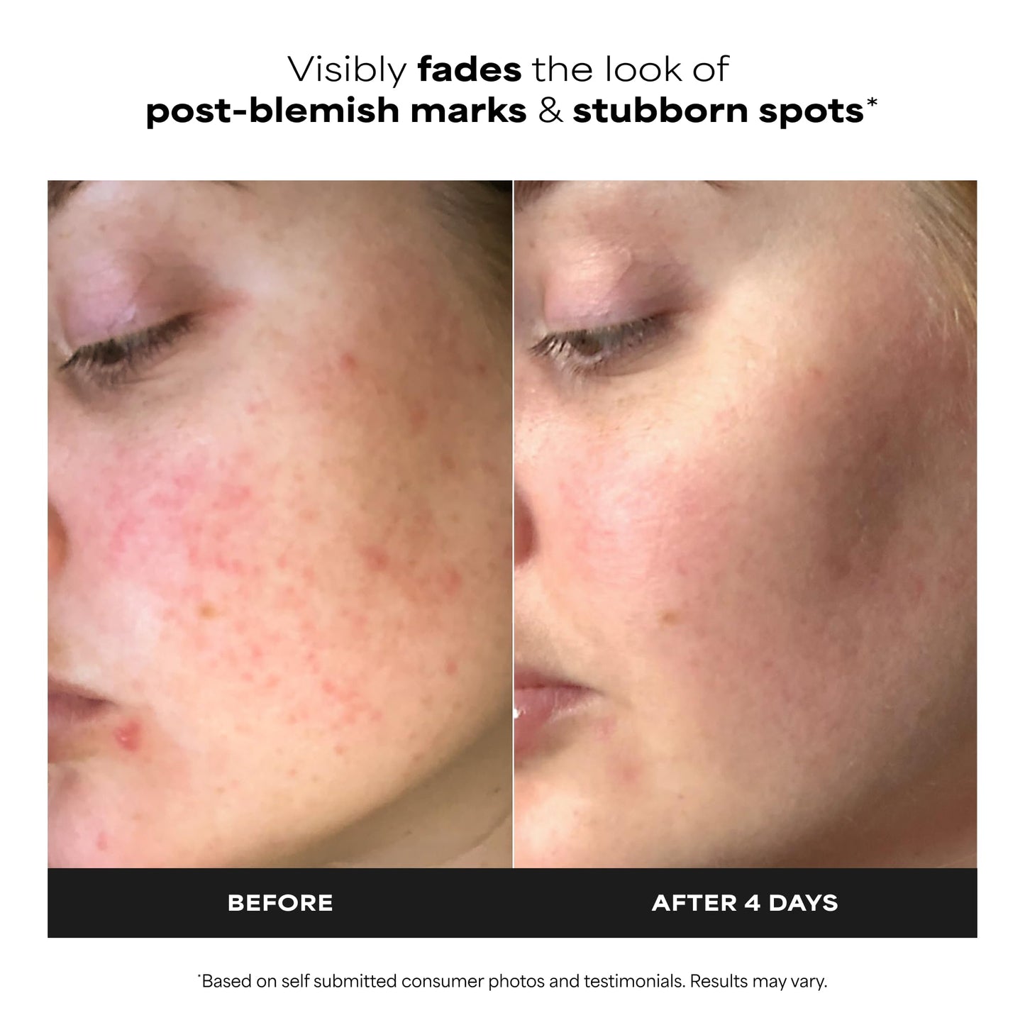 Paula's Choice BOOST 10% Azelaic Acid Booster Cream Gel, Licorice Extract & Salicylic Acid, Oil-Free Skin Serum, Fragrance-Free, 30 ml - Available at All In One Marketplace Canada