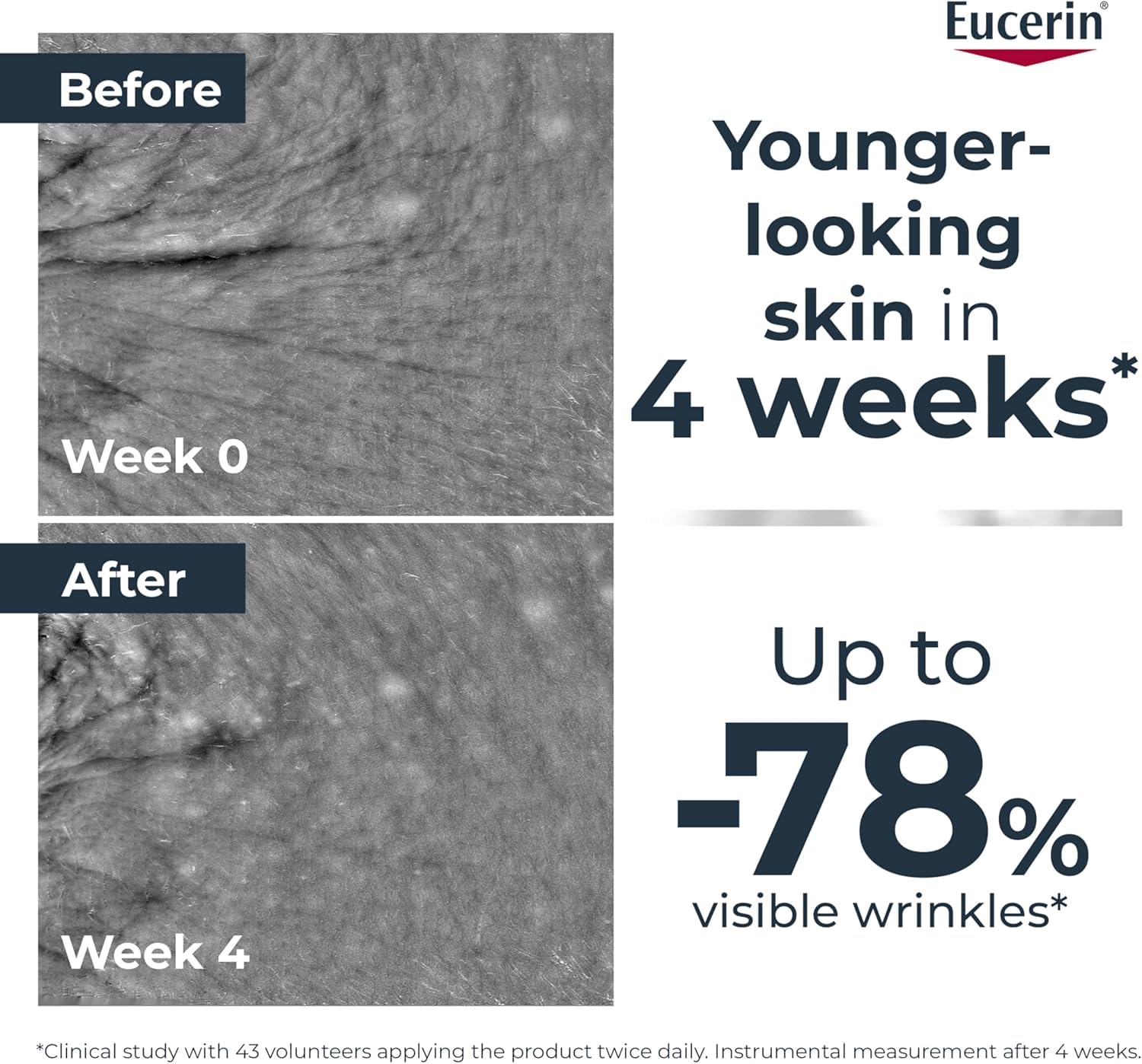Eucerin Anti Wrinkle Epicelline Hyaluronic Acid Serum for Face, Anti Aging Face Serum for Women Visibly Rejuvenates the Look of Skin, All Skin Types, 30mL Bottle - Available at All In One Marketplace Canada