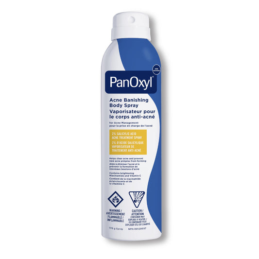 PanOxyl Acne Banishing Body Spray with 2% Salicylic Acid, Pimple Treatment to Help Clear Stubborn Breakouts, 360-Degree Spray Nozzle, Skin-Brightening Niacinamide, Vitamin C, Witch Hazel, Aloe, 170g