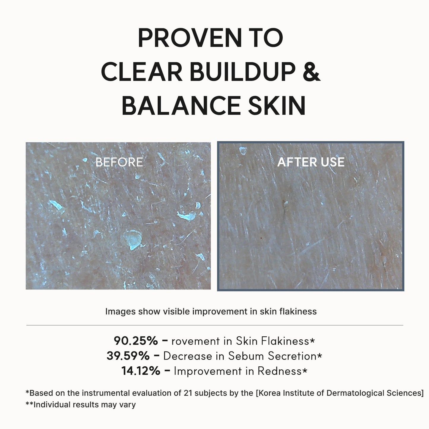 Arencia Eraser Serum Glycolic Acid Booster with AHA BHA, Exfoliating Face Serum for Acne-Prone Skin, Pore Care & Texture Refining, Lightweight Daily Skincare, 30 mL - Available at All In One Marketplace Canada