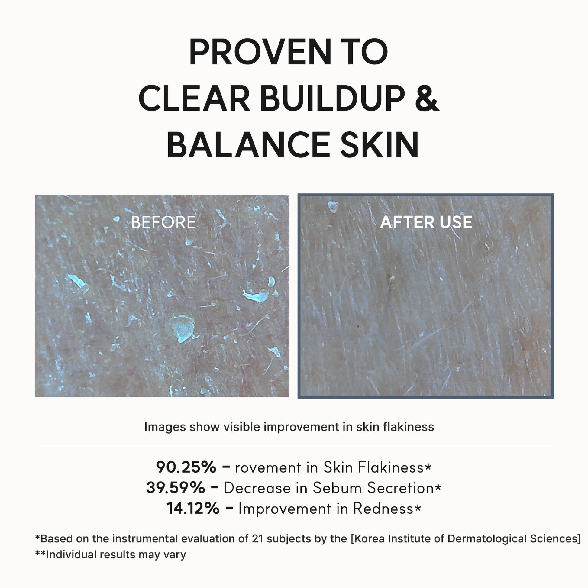 Arencia Eraser Serum Glycolic Acid Booster with AHA BHA, Exfoliating Face Serum for Acne-Prone Skin, Pore Care & Texture Refining, Lightweight Daily Skincare, 30 mL - Available at All In One Marketplace Canada