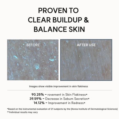 Arencia Eraser Serum Glycolic Acid Booster with AHA BHA, Exfoliating Face Serum for Acne-Prone Skin, Pore Care & Texture Refining, Lightweight Daily Skincare, 30 mL - Available at All In One Marketplace Canada