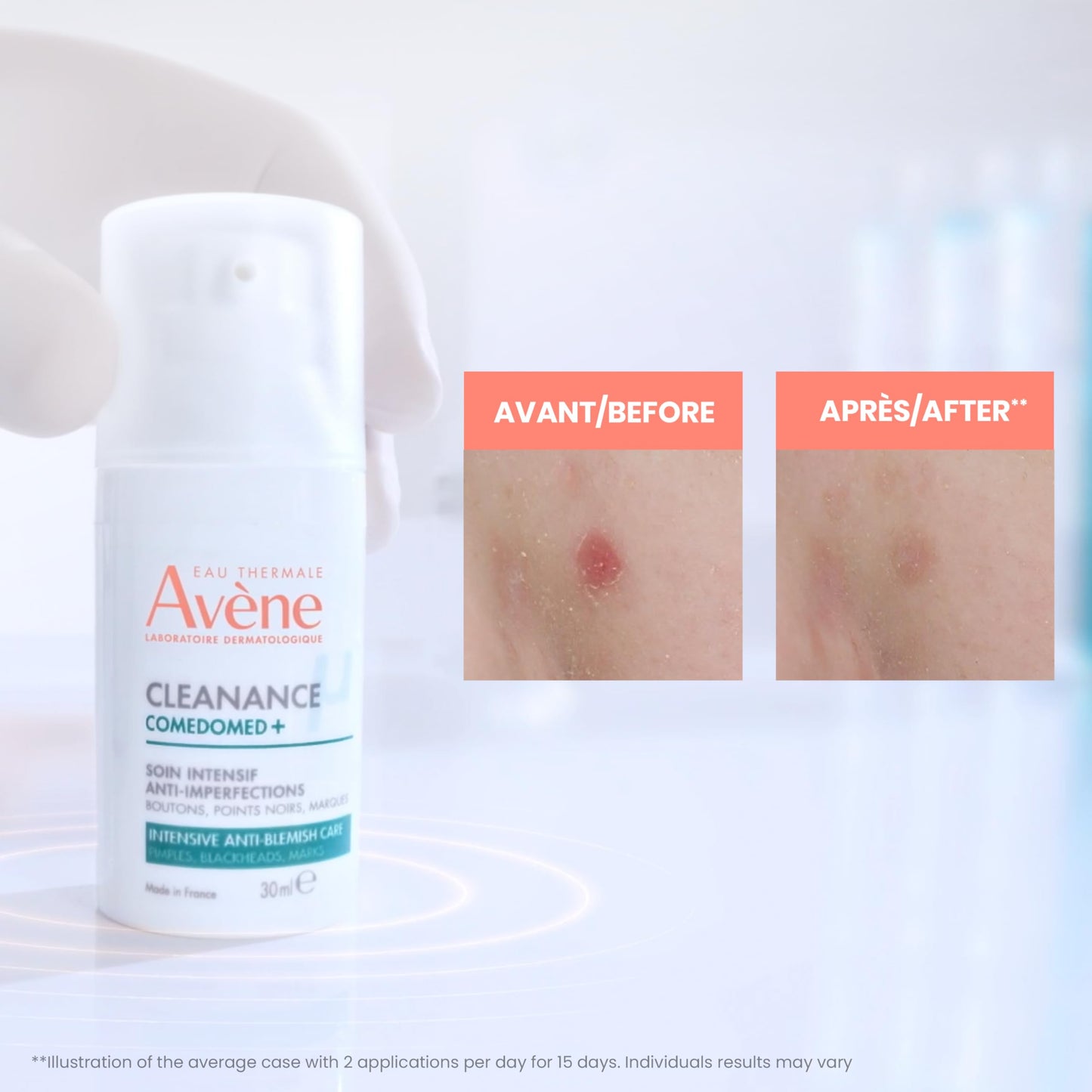 Eau Thermale Avene Cleanance Comedomed+ anti-blemish cream, niacinamide, 30 ml EAU THERMALE AVENE