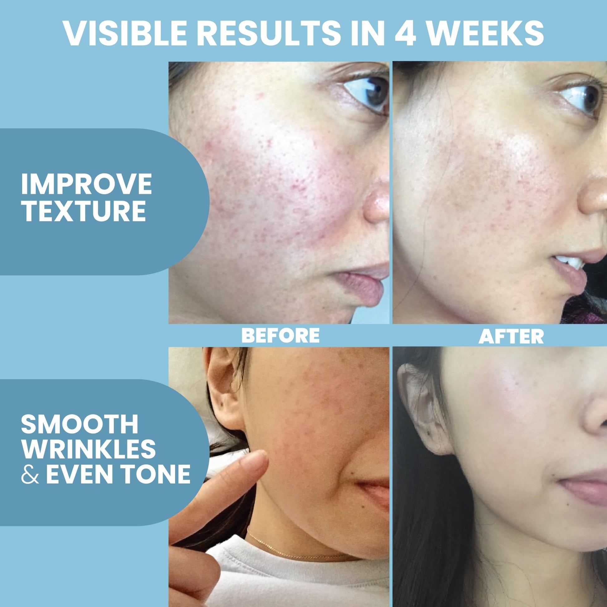 Eva Naturals Peptide Serum for Face – Collagen Boosting Anti-Aging Facial Serum for Wrinkles, Fine Lines & Microneedling – Skin Firming, Smoothing & Hydrating Peptides Booster - Available at All In One Marketplace Canada