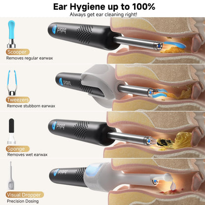 Bebird Ear Wax Removal Tools, Bebird Ear Cleaner, 1080P HD Endoscope, Wireless Earwax Removal Tools with 6 LED Lights, Compatible with iPhone & Android and Kids, Adults (Black) - Available at All In One Marketplace Canada