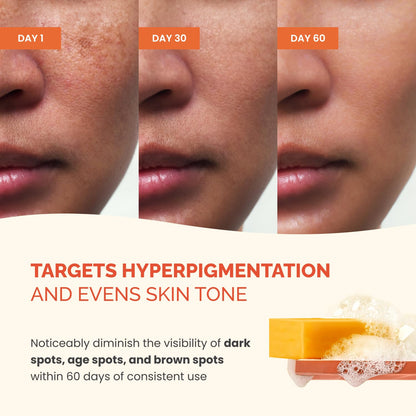 PLANTIFIQUE Kojic Acid Soap for Hyperpigmentation, Lab Tested - Turmeric Soap 2 Bars with Hyaluronic Acid, Collagen, Vitamin C for Dark Spots - Face Wash, 160g / 5.64 oz