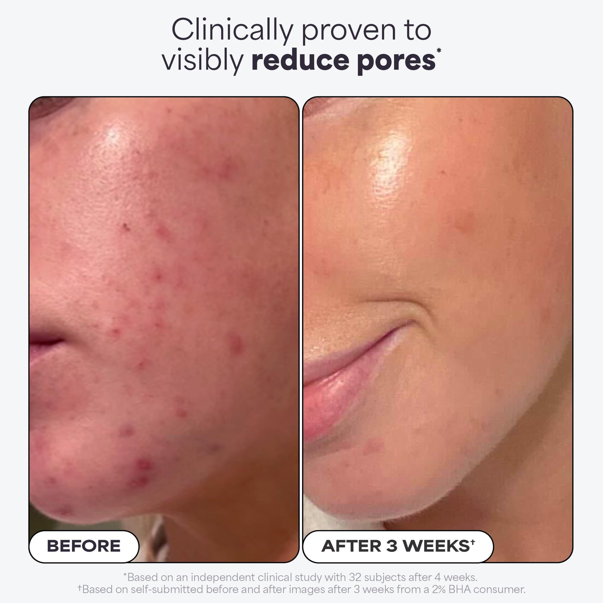 Paula's Choice SKIN PERFECTING 2% BHA Liquid Salicylic Acid Exfoliant Duo, Gentle Exfoliator for Enlarged Pores, Wrinkles & Fine Lines, Includes 1 Full Size Bottle & 1 Travel Size Bottle