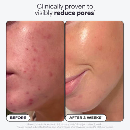 Paula's Choice SKIN PERFECTING 2% BHA Liquid Salicylic Acid Exfoliant Duo, Gentle Exfoliator for Enlarged Pores, Wrinkles & Fine Lines, Includes 1 Full Size Bottle & 1 Travel Size Bottle