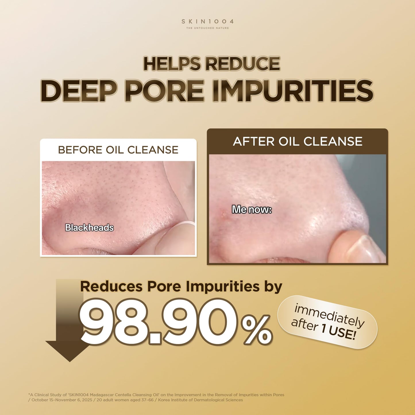 SKIN1004 Madagascar Centella Light Cleansing Oil (6.76 Fluid Ounce) Pure and light oil with fresh cleansing effect, Micellar Cleansing Hypoallergenic Use 🍁 All In One Marketplace Canada