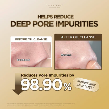 SKIN1004 Madagascar Centella Light Cleansing Oil (6.76 Fluid Ounce) Pure and light oil with fresh cleansing effect, Micellar Cleansing Hypoallergenic Use 🍁 All In One Marketplace Canada
