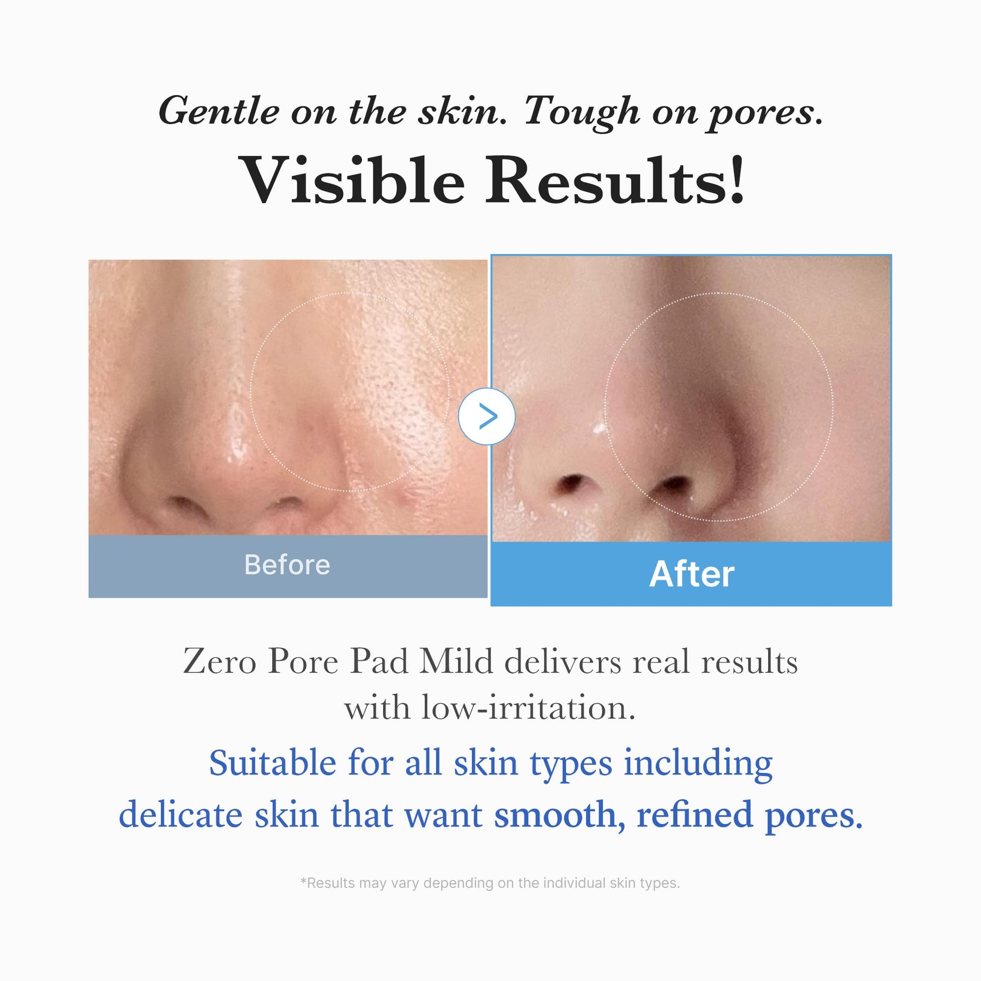 medicube Zero Pore Mild Pad 70 pads - Available at All In One Marketplace Canada
