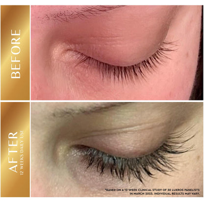 LUXROS Eyelash Serum 5 mL, Eyelash Enhancer Serum for Longer, Thicker Healthier Lashes, Made in USA, 5mL 6 Month Supply - Available at All In One Marketplace Canada