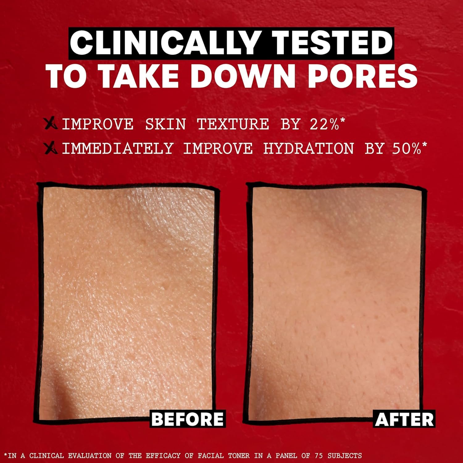 Thayers Witch Hazel Face Toner, With Rose Petal, Aloe Vera, Glycerin, No Alcohol, Glass Skin, Reduces Pores, Smoothes Texture, 8 Hour Hydration, Suitable For All Types From Dry To Oily, Vegan, 355ml