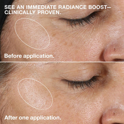 Clinique 3-Step Clarifying Lotion Face Exfoliator For Dry Combination Skin Types, Dry Combination Skin, 500ml Clinique