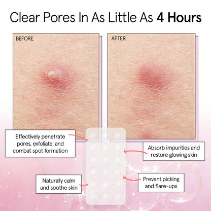 grace & stella Award Winning Invisible Skin Rescue Covers with Hydrocolloid (Round, 36 Count) - With Salicylic Acid and Tea Tree for Absorbing Impurities - Dermatologist Tested Skin Care, Cruelty Free, Vegan