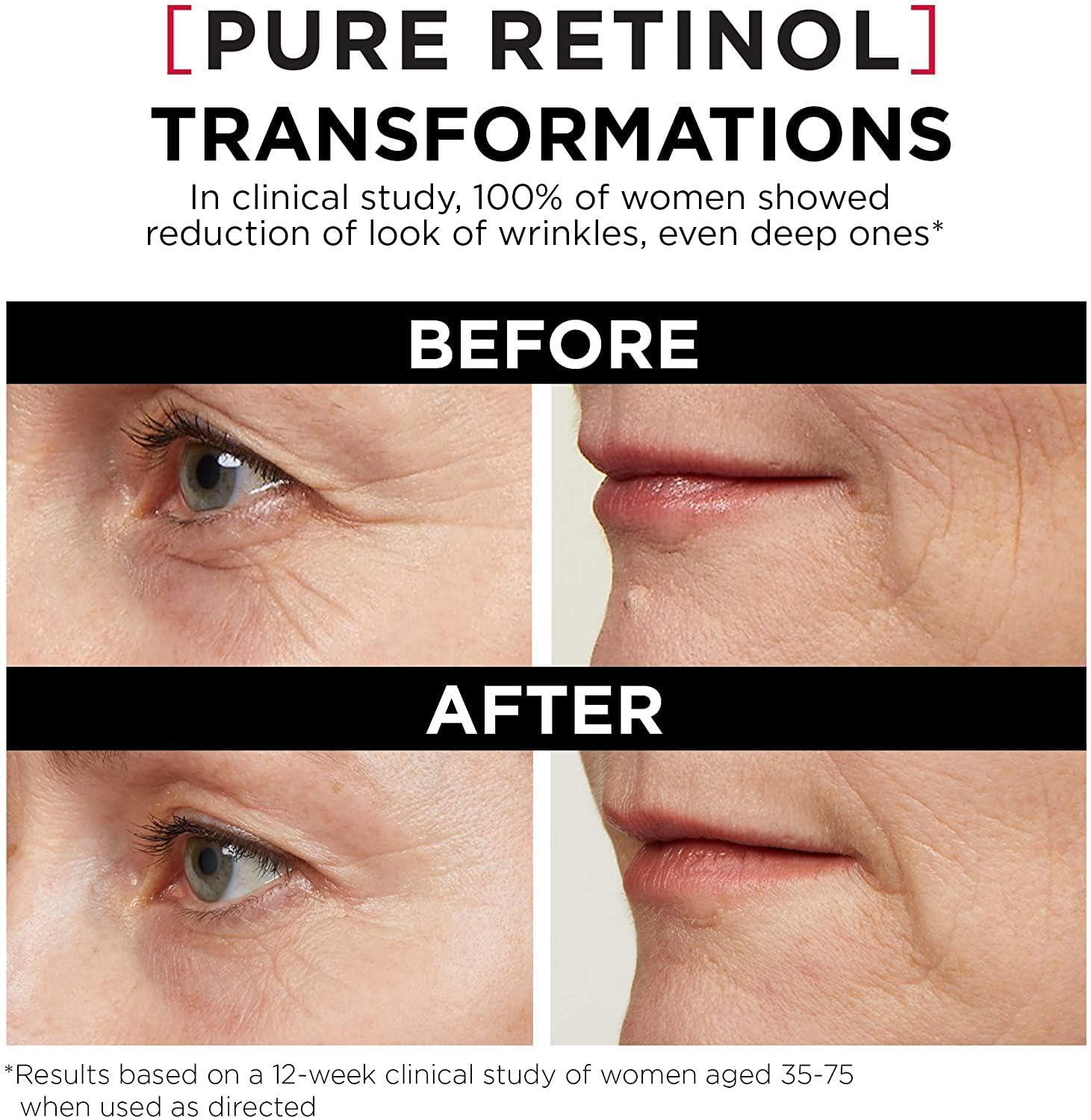 L'Oreal Paris 0.3% Pure Retinol Serum for Face, Night Serum Visibly Reduces the Look of Deep Wrinkles & Smoothes Texture, Revitalift Derm Intensives, 30ml - Available at All In One Marketplace Canada