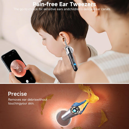 Bebird Ear Wax Removal Tools, Bebird Ear Cleaner, 1080P HD Endoscope, Wireless Earwax Removal Tools with 6 LED Lights, Compatible with iPhone & Android and Kids, Adults (Black) - Available at All In One Marketplace Canada