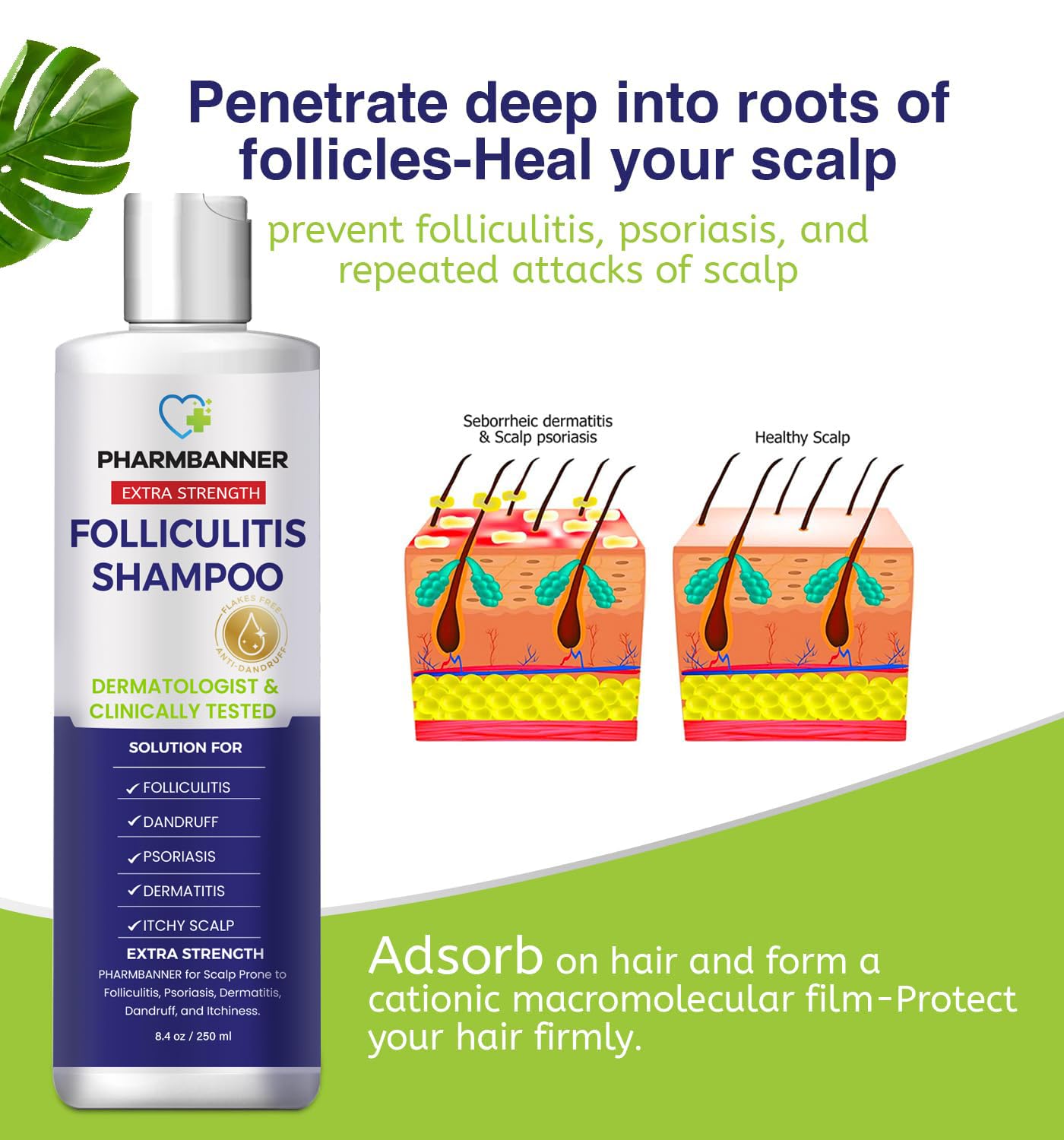 Folliculitis & Seborrheic Dermatitis Shampoo – Anti-Dandruff Scalp Care for Itchy, Flaky, Dry Scalp, Helps Relieve Irritation & Discomfort - Available at All In One Marketplace Canada