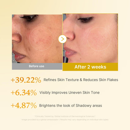 medicube Kojic Acid Turmeric Smoothing Toner for Face & Body | Lightweight Toner for Balancing Uneven Skin Tone & Texture | Niacinamide, Glycolic Acid for Clear Glass Skin | 8.45 fl.oz - Available at All In One Marketplace Canada