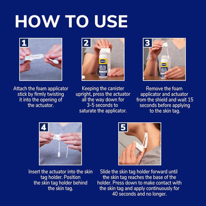 Dr. Scholl's Freeze Away Skin Tag Remover - At Home Skin tag Removal kit. Clinically Proven Skin Tag Removal in as Little as 1 Treatment. 1 Skin tag Removal kit, 12 Treatments - Available at All In One Marketplace Canada