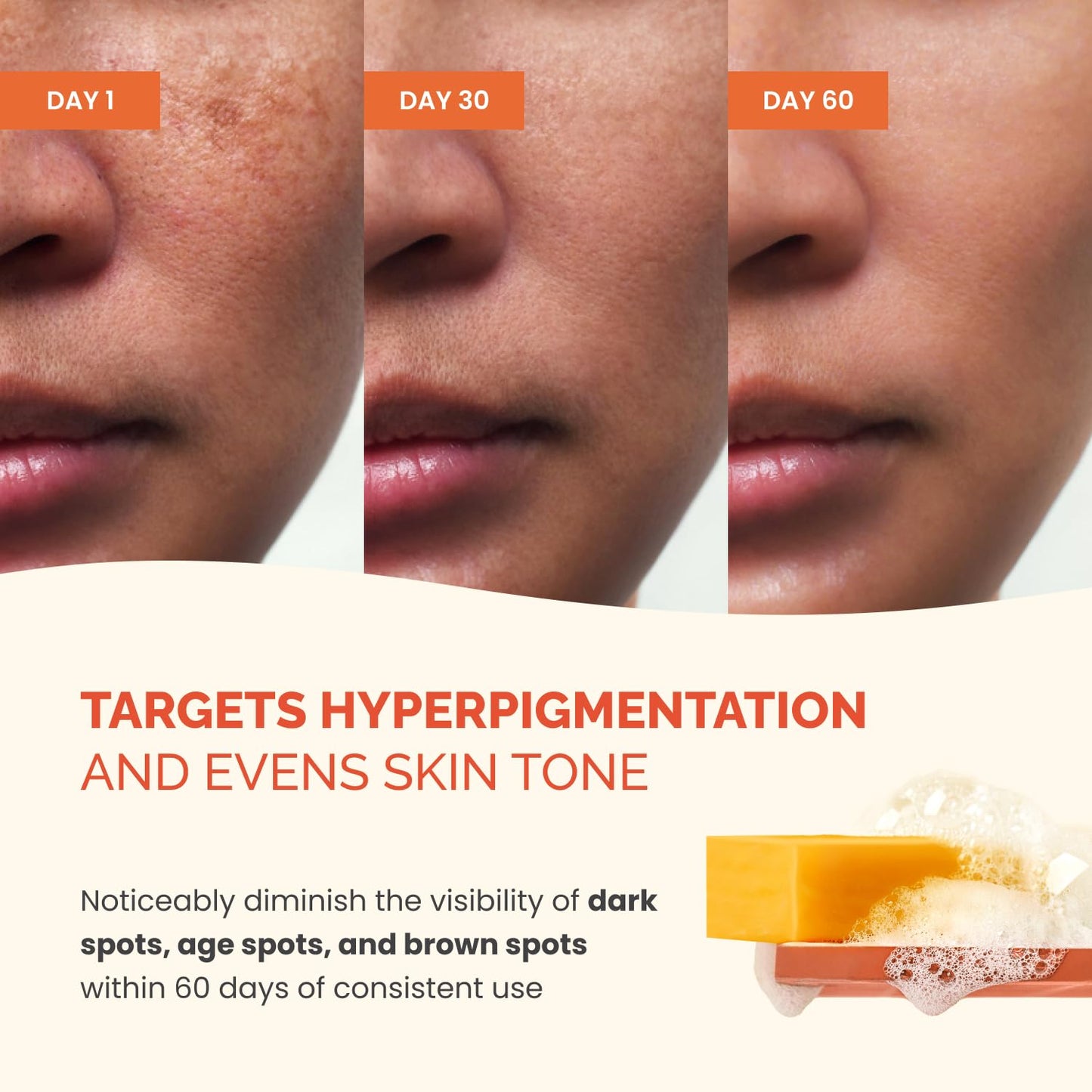 PLANTIFIQUE Turmeric & Kojic Acid Soap for Hyperpigmentation, Lab Tested - 4 Bars with Mesh Net - Face & Body Wash with Hyaluronic Acid, Collagen, Vitamin C - 320g / 11.28 oz