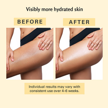 Firming Body Massage Oil with Collagen & Stem Cell – Helps Smooth the Appearance of Cellulite & Improve Skin Texture – Refreshing Aromatherapy Oil for Legs & Full Body – 8 fl oz by M3 - Available at All In One Marketplace Canada