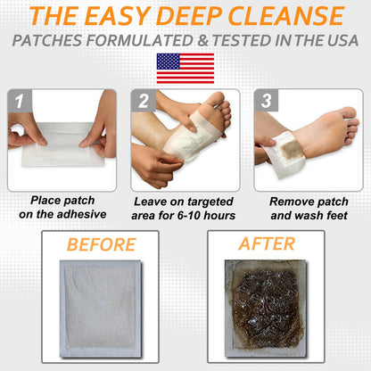 Dr. Entre's Foot Patch: Deep Cleansing Foot Pads | Effective Premium Turmeric & Ginger Foot Patches | 20 Pack - Available at All In One Marketplace Canada