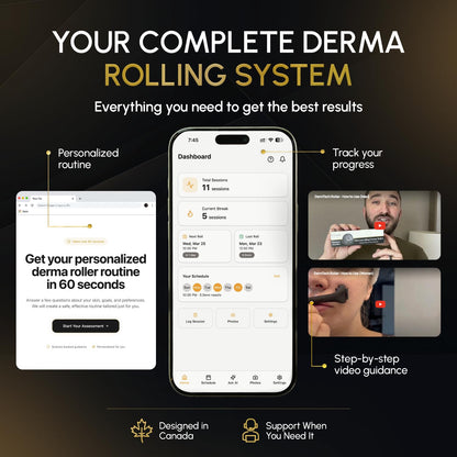 Derma Microneedling Roller - 1.5mm Titanium Needles - Designed in Canada - for Men and Women - Storage Case Included (Matte Black) - Available at All In One Marketplace Canada