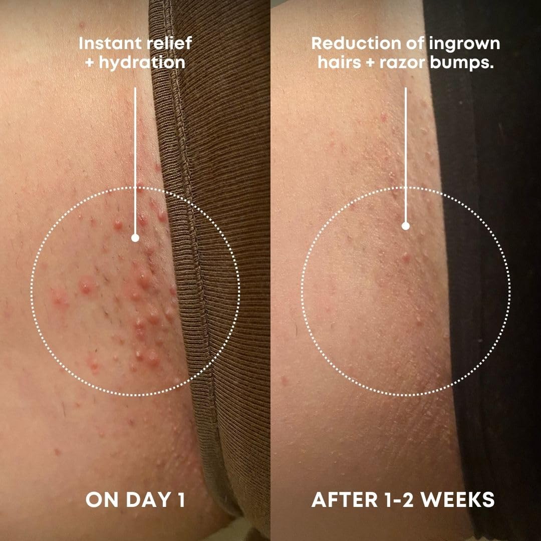 Bushbalm Ingrown Hair Exfoliating Scrub - Reduces Appearance of Ingrown Hairs and Razor Bumps, Soothes Skin and Post-Shave Redness - Nude, 236 ml - Available at All In One Marketplace Canada