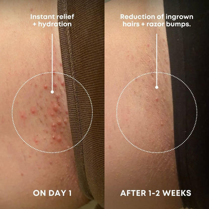 Bushbalm Ingrown Hair Exfoliating Scrub - Reduces Appearance of Ingrown Hairs and Razor Bumps, Soothes Skin and Post-Shave Redness - Nude, 236 ml - Available at All In One Marketplace Canada