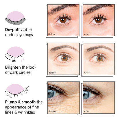 grace & stella Under Eye Patches (12 pairs) Eye Masks for Dark Circles and Puffiness - Birthday Gifts for Women, Bachelorette Party Favors, Bridesmaid Proposal Gifts, Self Care, Spa, Relaxation, Vegan