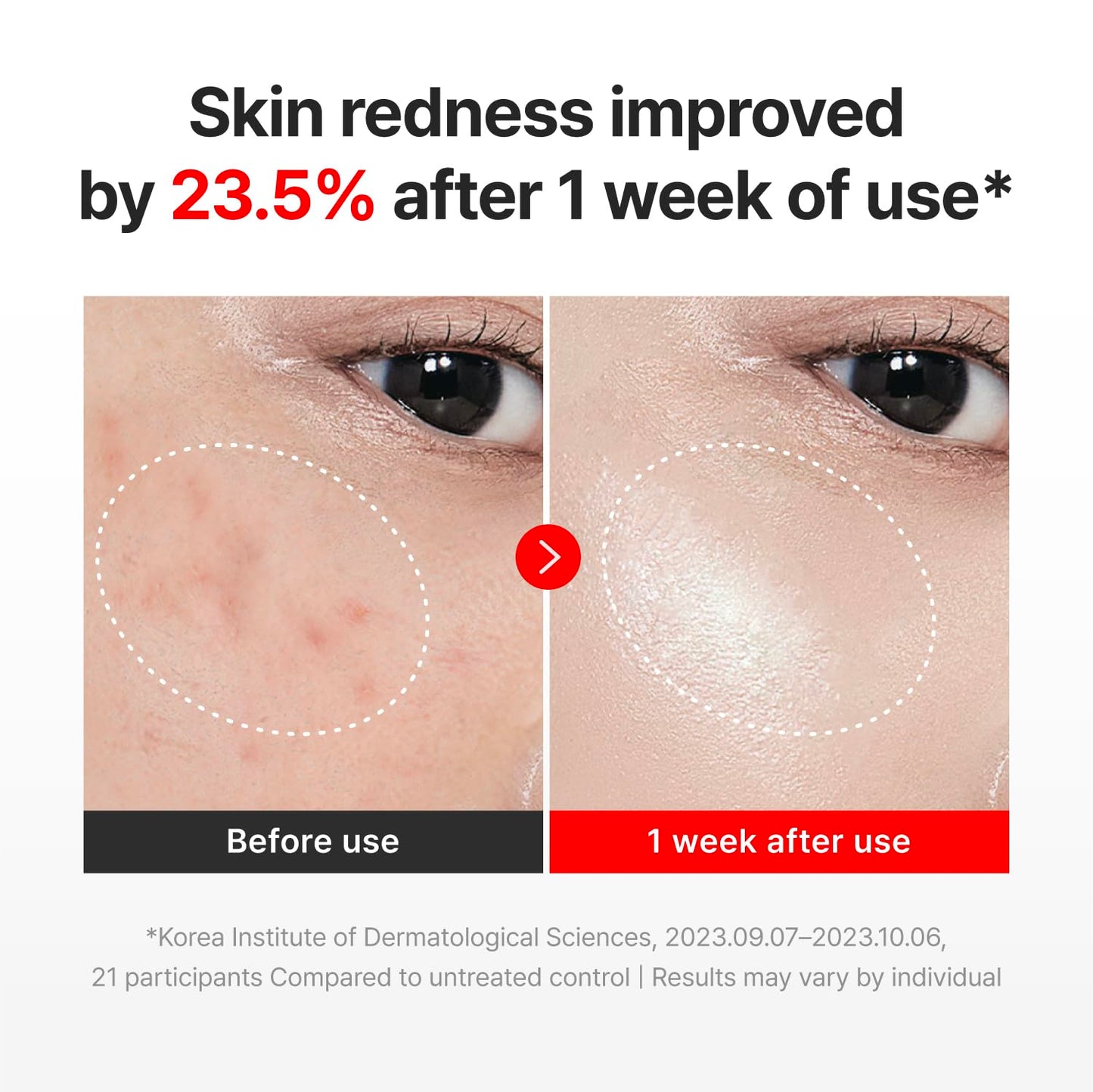 CENTELLIAN 24 Madeca Cream Time Reverse (1.69fl oz) - Advanced Fast-Absorbing & Nourishing, Hydrates, Firms & Reduces Wrinkles, Low Irritation, Korean Skin Care Centella Asiatica, Collagen - Available at All In One Marketplace Canada