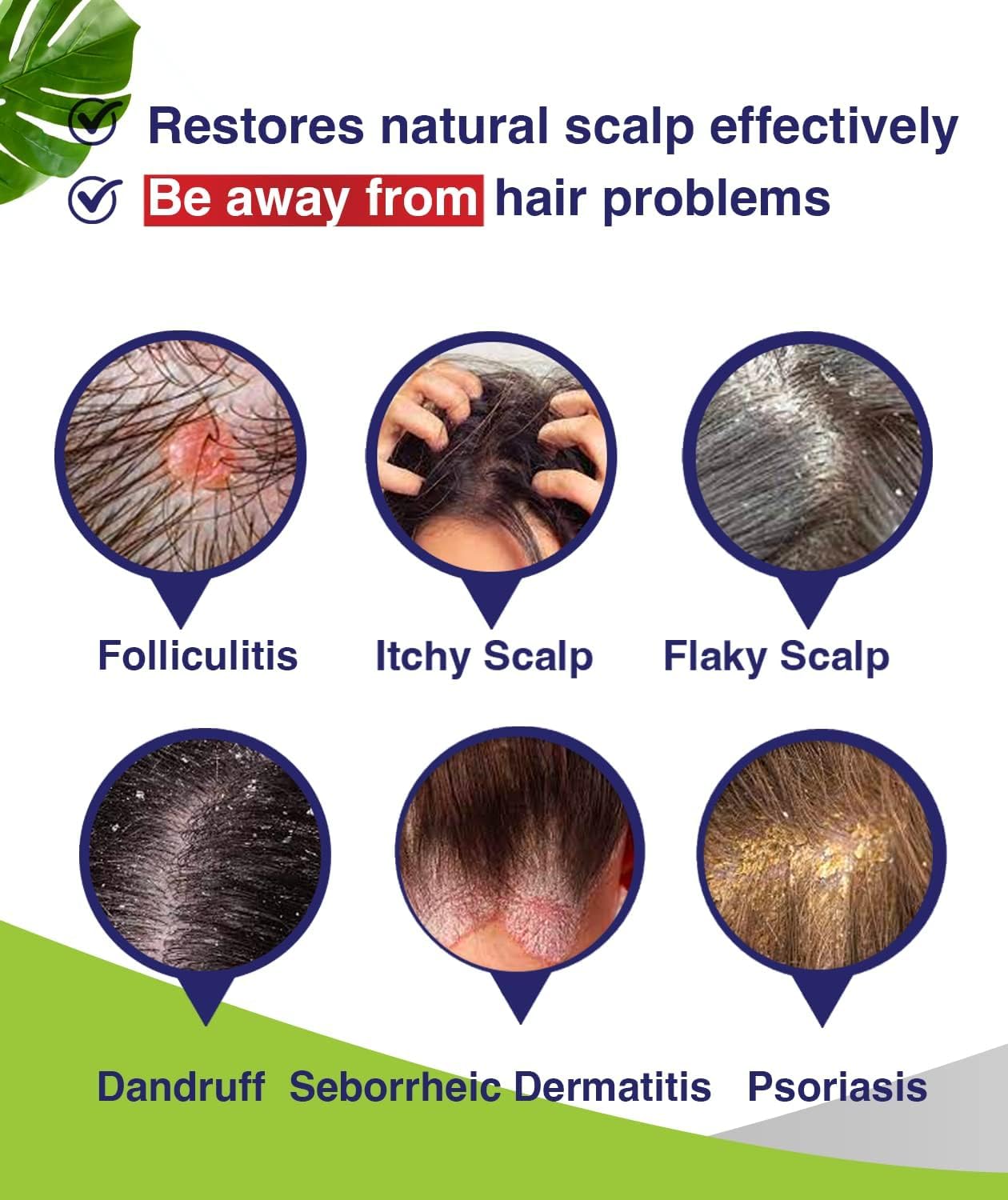 Folliculitis & Seborrheic Dermatitis Shampoo – Anti-Dandruff Scalp Care for Itchy, Flaky, Dry Scalp, Helps Relieve Irritation & Discomfort - Available at All In One Marketplace Canada