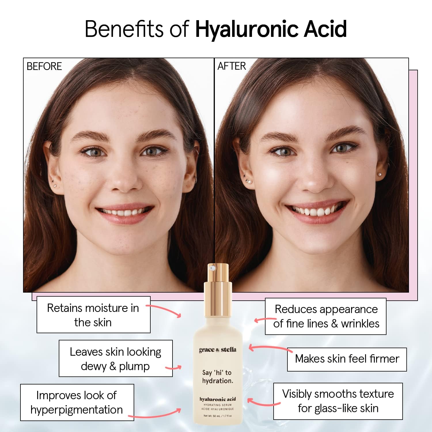 grace & stella Award Winning Hyaluronic Acid Serum for Face (50ml) Hydrating Hyaluronic Acid - Acide Hyaluronique Face - Anti Aging Serum to Hydrate, Remove Fine Lines, Wrinkles, Boost Collagen - Available at All In One Marketplace Canada