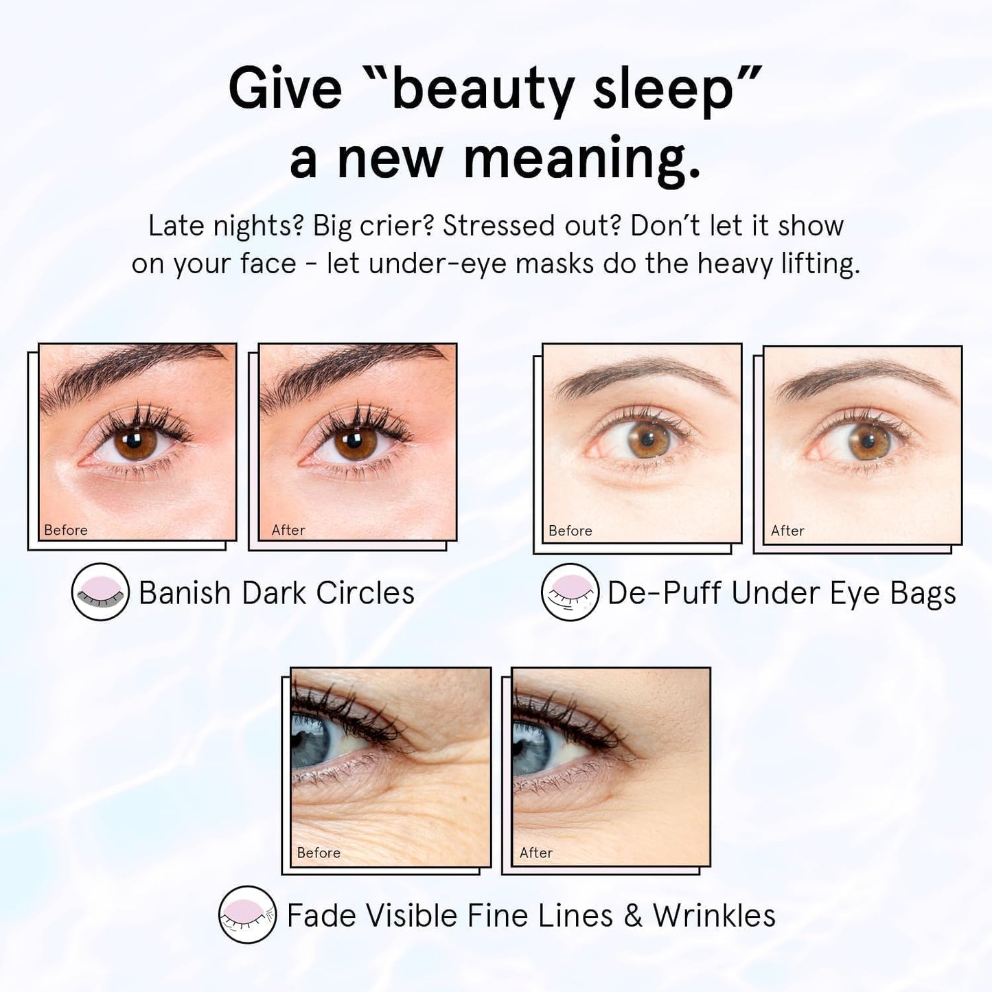grace & stella Under Eye Masks With Retinol - Revitalizing Under Eye Patches for The Wrinkles & Dark Circles - Gel Eye Mask - Gifts for Mom, Teen Girl Gifts - Vegan, Cruelty-Free (24 Pairs)