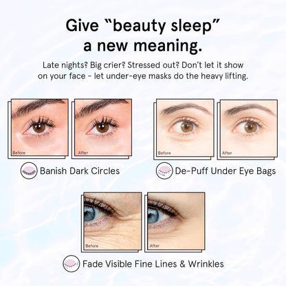 grace & stella Under Eye Masks With Retinol - Revitalizing Under Eye Patches for The Wrinkles & Dark Circles - Gel Eye Mask - Gifts for Mom, Teen Girl Gifts - Vegan, Cruelty-Free (24 Pairs)